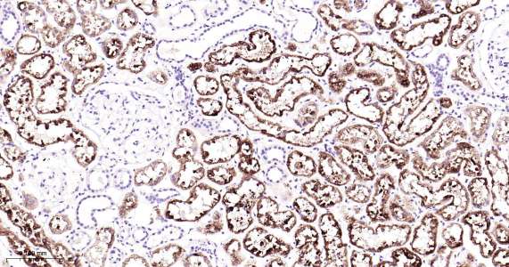 人环氧合酶2即用型免疫组化试剂盒-IHC0408H